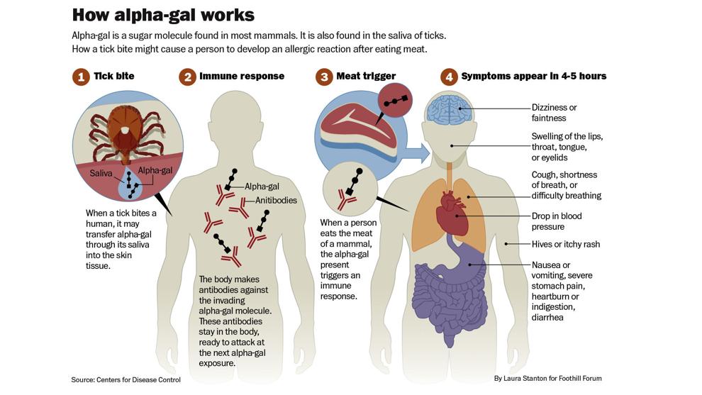 Alpha-gal Syndrome: The link between ticks and red-meat allergy